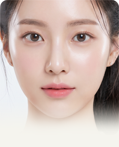 이로성형외과 환자 사진