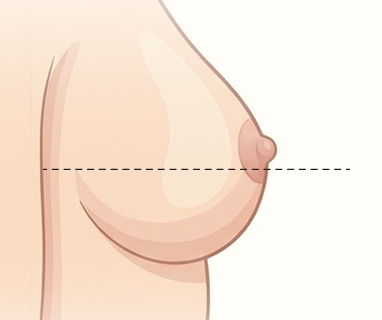 정상