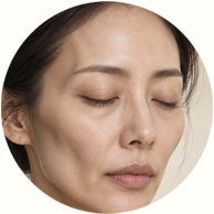 얼굴 볼륨 감소 예시